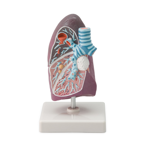 Pathological Model Of The Lung